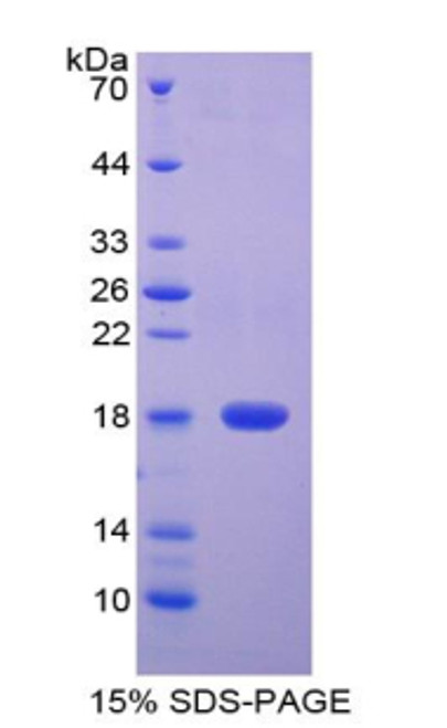 Rat Recombinant Cytotoxic T-Lymphocyte Associated Antigen 4 (CTLA4)