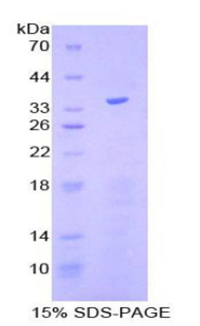 Human Recombinant Kruppel Like Factor 4, Gut (KLF4)