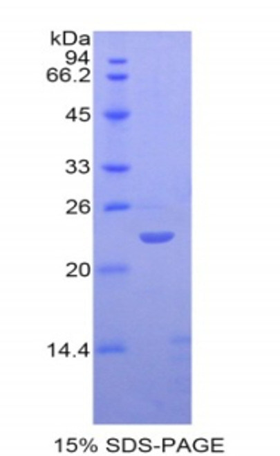 Human Recombinant Sialic Acid Binding Ig Like Lectin 12 (SIGLEC12)