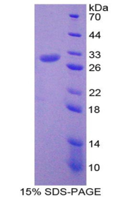 Mouse Recombinant Programmed Cell Death Protein 6 Interacting Protein (PDCD6IP)