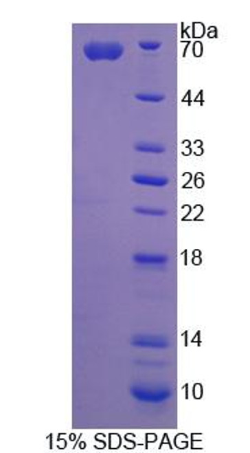 Rat Recombinant Angiostatin (ANG)