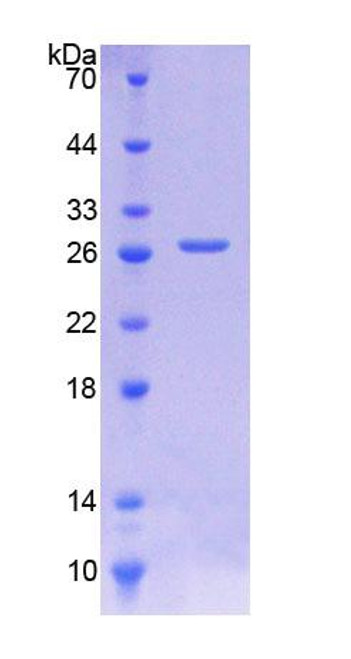 Human Recombinant Cathepsin D (CTSD)