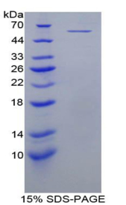 Mouse Recombinant V-Myc Myelocytomatosis Viral Oncogene Homolog (MYC)