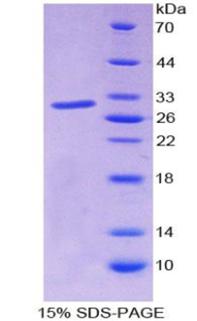 Human Recombinant V-Jun Sarcoma Virus 17 Oncogene Homolog (JUN)