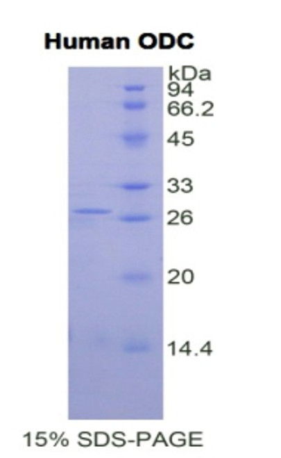 Human Recombinant Ornithine Decarboxylase (ODC)