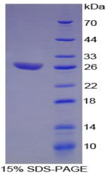 Human Recombinant Activating Transcription Factor 1 (ATF1)