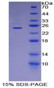 Human Recombinant Adipose Differentiation Related Protein (ADRP)