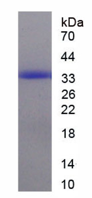 Human Recombinant Arachidonate-5-Lipoxygenase (ALOX5)