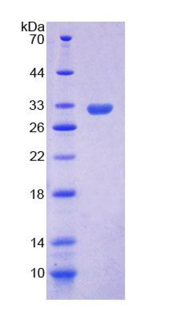 Human Recombinant Apoptosis Signal Regulating Kinase 1 (ASK1)