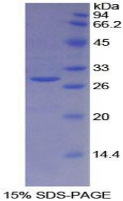 Human Recombinant Breast Cancer Susceptibility Protein 2 (BRCA2)