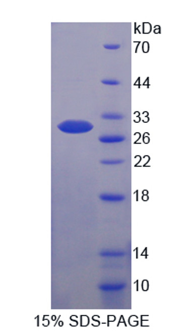 Mouse Recombinant Breast Cancer Susceptibility Protein 2 (BRCA2)