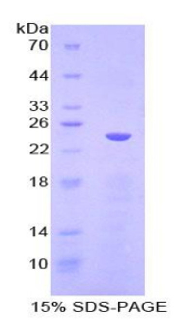 Mouse Recombinant Cadherin 5 (CDH5)