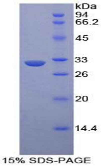 Human Recombinant Ephrin Type A Receptor 1 (EPHA1)