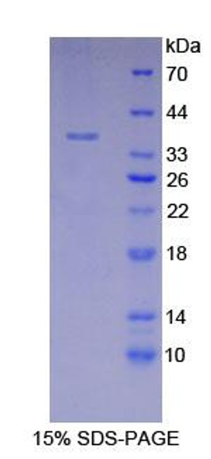 Mouse Recombinant Lactate Dehydrogenase A (LDHA)