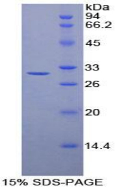 Mouse Recombinant Transaldolase (TALDO1)