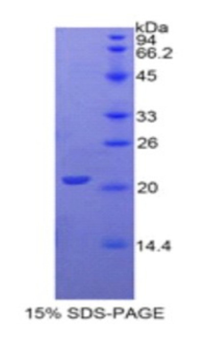 Human Recombinant Gamma-Glutamyltransferase 1 (gGT1)