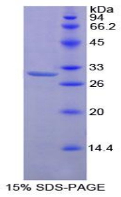 Mouse Recombinant Protein Kinase C Zeta (PKCz)