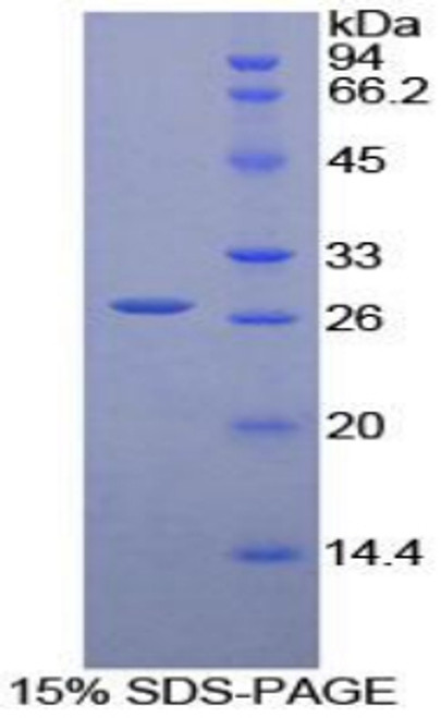 Human Recombinant Leukocyte Immunoglobulin Like Receptor Subfamily A, Member 3 (LILRA3)