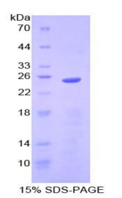 Human Recombinant Neutrophil Gelatinase Associated Lipocalin (NGAL)