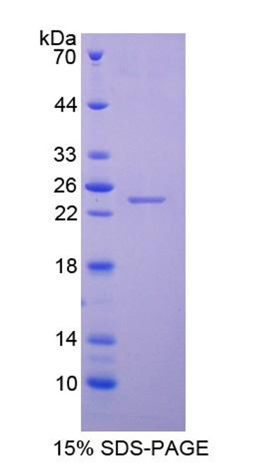 Pig Recombinant Neutrophil Gelatinase Associated Lipocalin (NGAL)