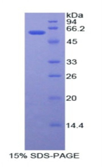 Human Recombinant Adenosine Deaminase (ADA)