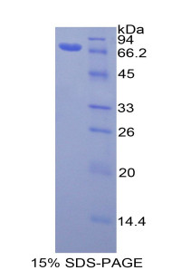 Human Recombinant Actin Gamma 1 (ACTg1)