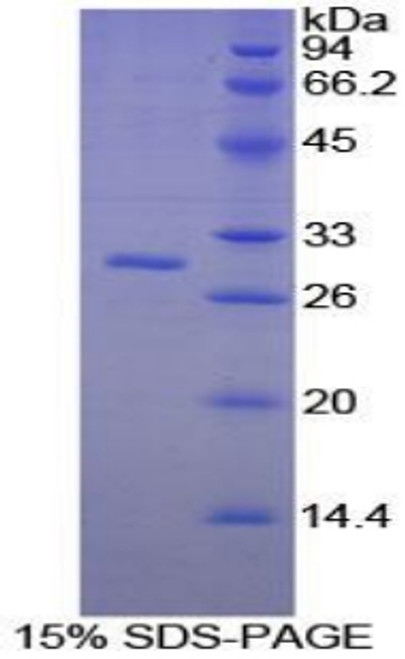 Mouse Recombinant Platelet Activating Factor Acetylhydrolase Ib3 (PAFAH1B3)