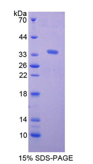 Rat Recombinant Complement Component 1, Q Receptor (C1qR1)