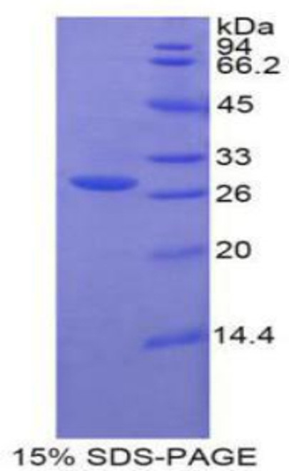 Human Recombinant Glucuronidase Beta (GUSb)