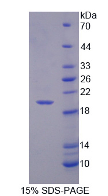 Human Recombinant Cluster Of Differentiation 99 (CD99)