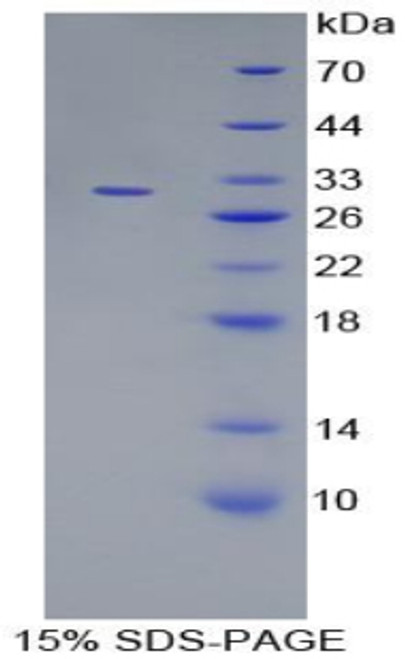 Mouse Recombinant Mitogen Activated Protein Kinase 7 (MAPK7)