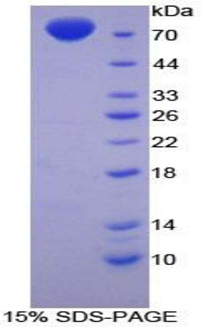 Chicken Recombinant Enolase, Muscle Specific (MSE)