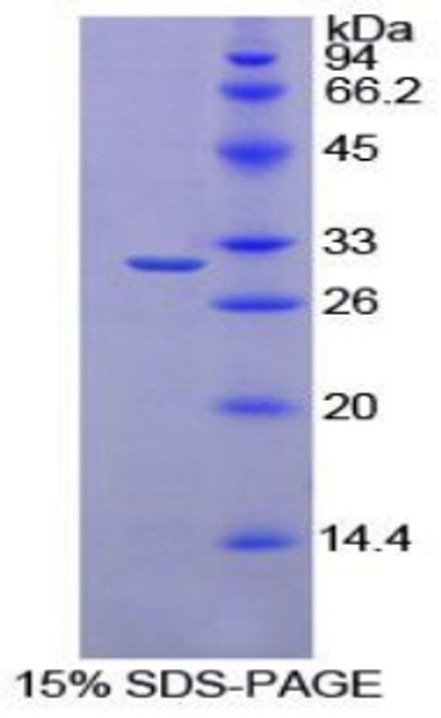 Rat Recombinant Ribonuclease Inhibitor (RI)