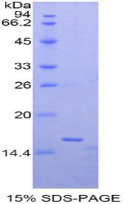 Human Recombinant Matrix Gla Protein (MGP)