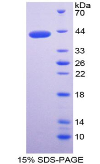 Pig Recombinant Matrix Gla Protein (MGP)