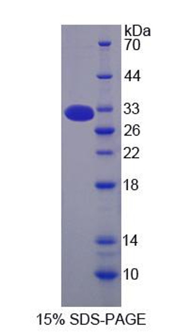Mouse Recombinant Mannose Binding Lectin (MBL) Mouse Recombinant Mannose Binding Lectin (MBL)