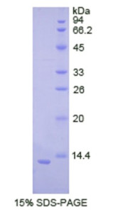 Human Recombinant Cadherin, Neuronal (CDH2)