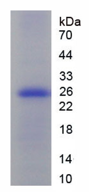 Human Recombinant Ornithine Carbamoyl Transferase (OCT)