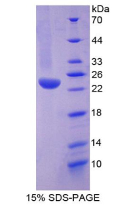 Human Recombinant Tumor Necrosis Factor Receptor Superfamily, Member 1A (TNFRSF1A) Human Recombinant Tumor Necrosis Factor Receptor Superfamily, Member 1A (TNFRSF1A)
