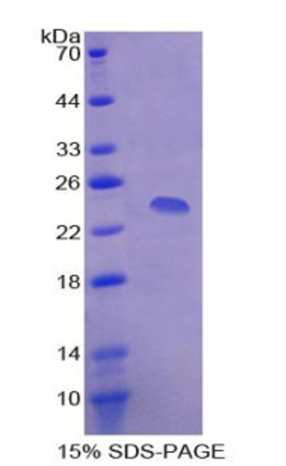 Human Recombinant Serum Amyloid P Component (SAP)