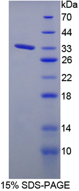 Rat Recombinant Protein Tyrosine Phosphatase Receptor Type J (PTPRJ)