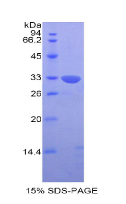 Human Recombinant Killer Cell Immunoglobulin Like Receptor 2DS4 (KIR2DS4)