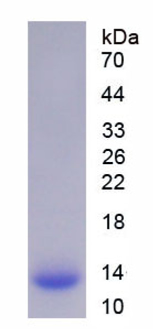 Human Recombinant Fatty Acid Binding Protein 1, Liver (FABP1)