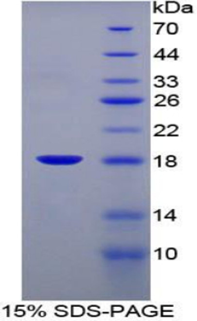 Mouse Recombinant Fatty Acid Binding Protein 1, Liver (FABP1)