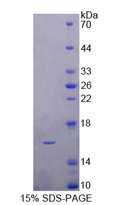 Pig Recombinant Fatty Acid Binding Protein 1, Liver (FABP1)