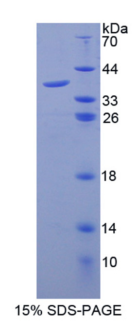 Cattle Recombinant Granulocyte Chemotactic Protein 2 (GCP2)