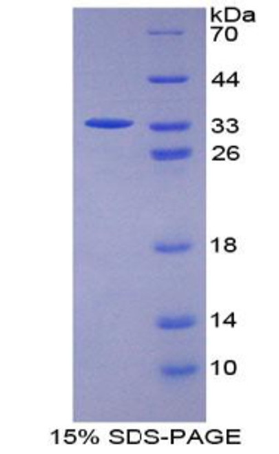 Human Recombinant Signal Transducing Adaptor Molecule 1 (STAM1)