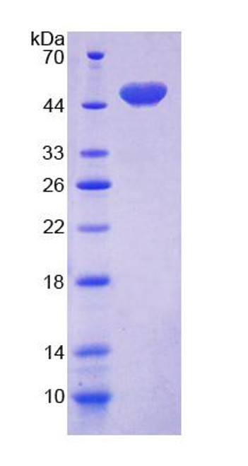 Human Recombinant Cluster Of Differentiation 164 (CD164)