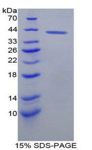 Rat Recombinant B-Lymphocyte Chemoattractant 1 (BLC1)
