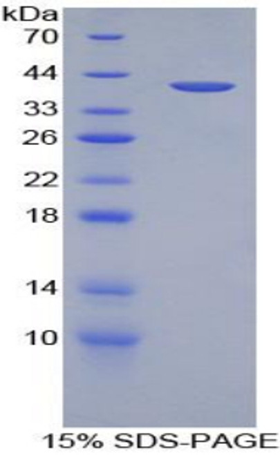 Mouse Recombinant Growth Regulated Oncogene Beta (GROb)